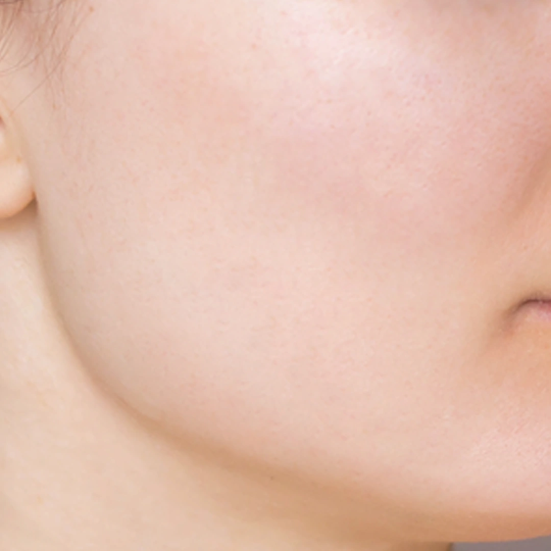 ReVive_Services_Before_&_After_Acne_Scar_Solutions_2