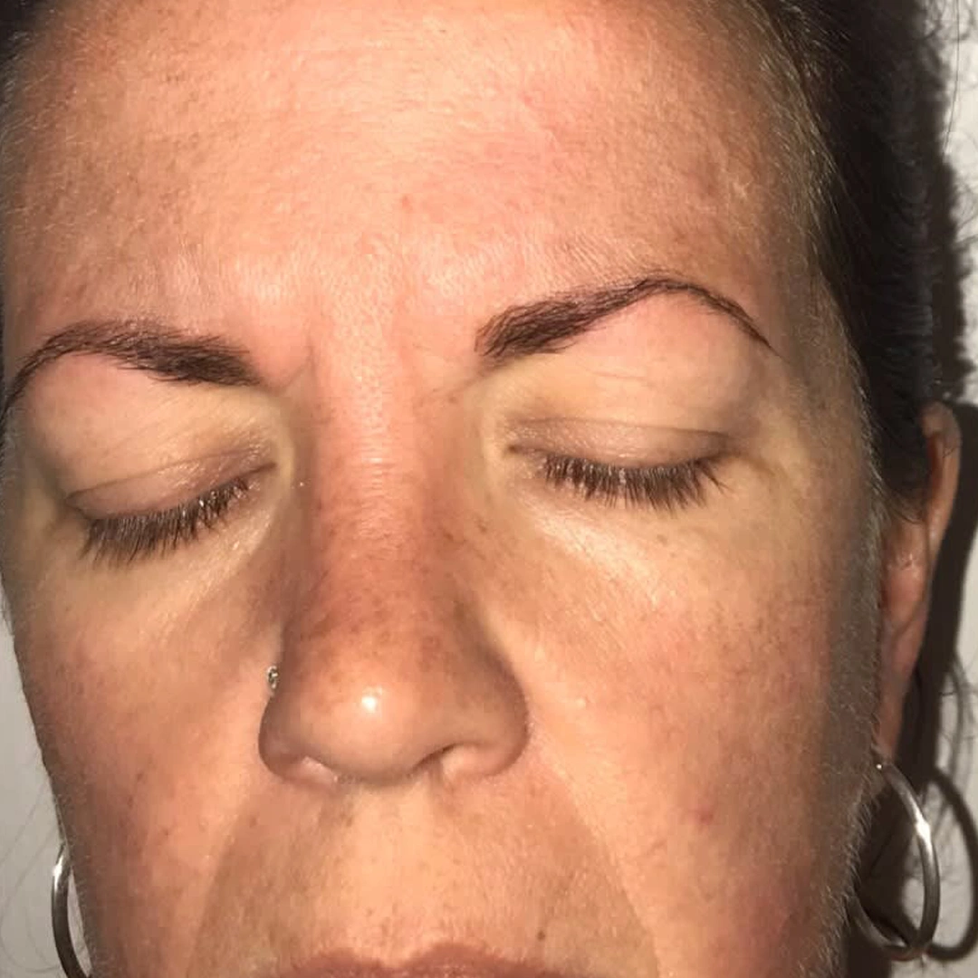 ReVive_Services_Before_&_After_B12_NAD_Injections_1 ReVive_Services_Before_&_After_B12_NAD_Injections_1