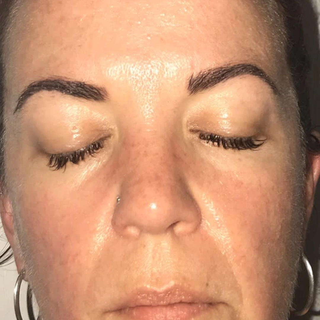 ReVive_Services_Before_&_After_B12_NAD_Injections_2 ReVive_Services_Before_&_After_B12_NAD_Injections_2