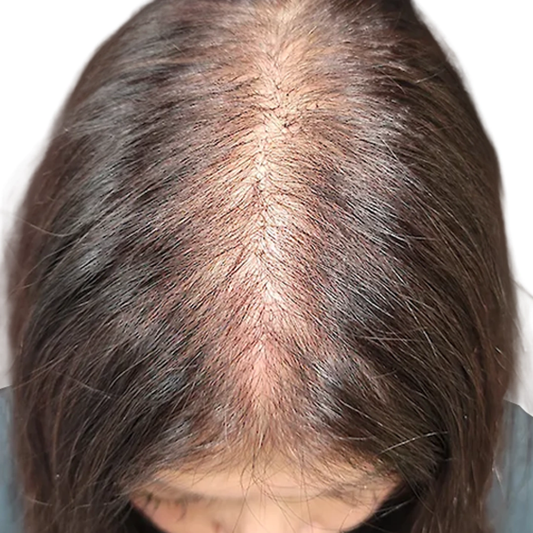 ReVive_Services_Before_&_After_Scalp_Therapy_1