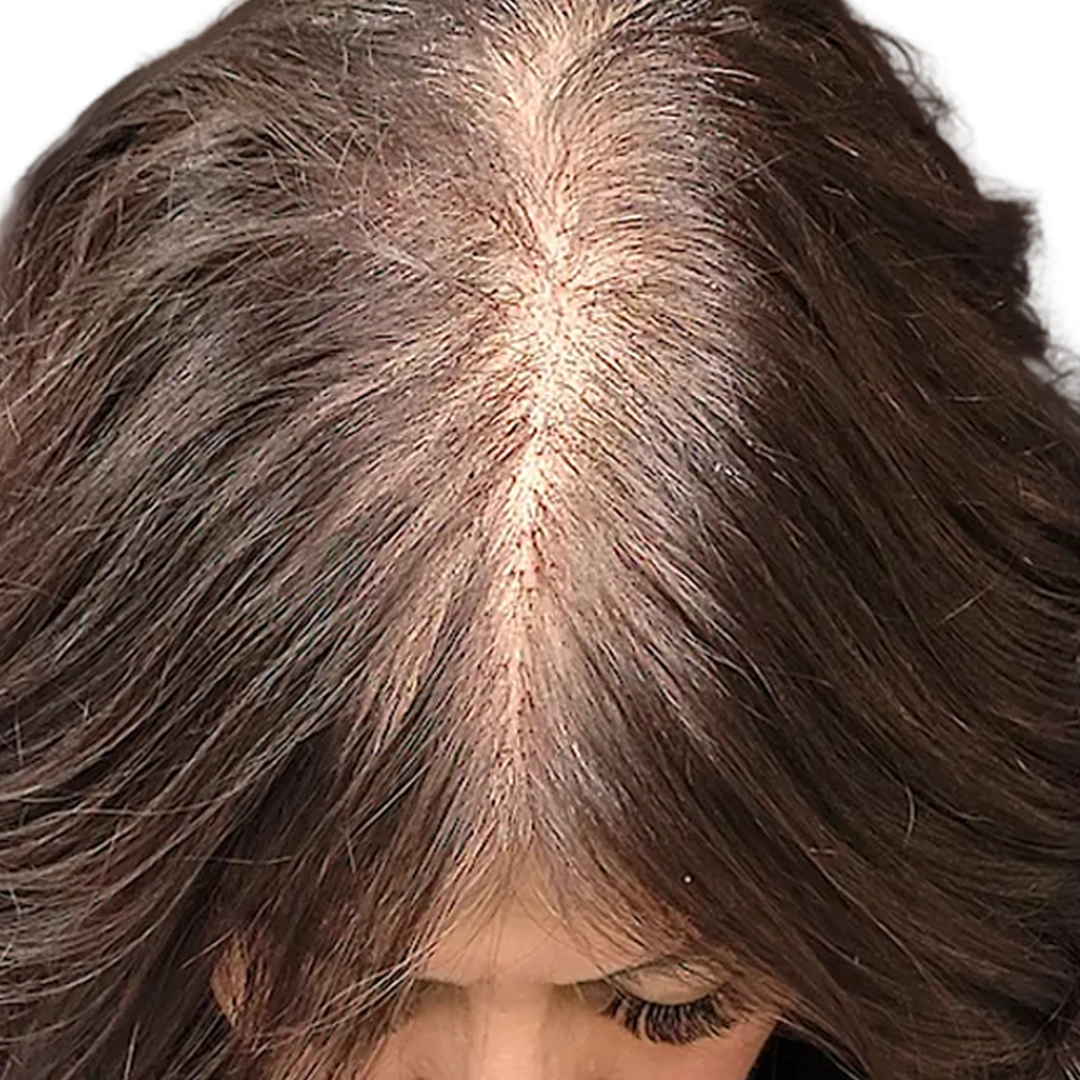 ReVive_Services_Before_&_After_Scalp_Therapy_2