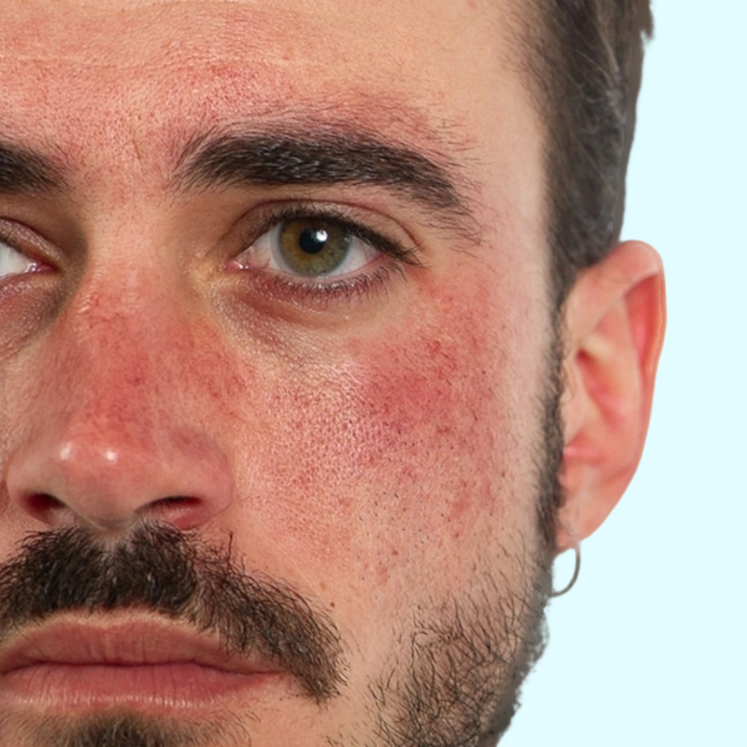 ReVive_Services_Before_&_After_Skin_Care_Facials_Men_1 ReVive_Services_Before_&_After_Skin_Care_Facials_Men_1