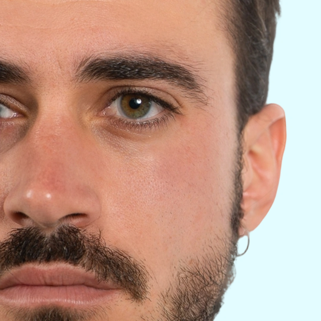 ReVive_Services_Before_&_After_Skin_Care_Facials_Men_2 ReVive_Services_Before_&_After_Skin_Care_Facials_Men_2