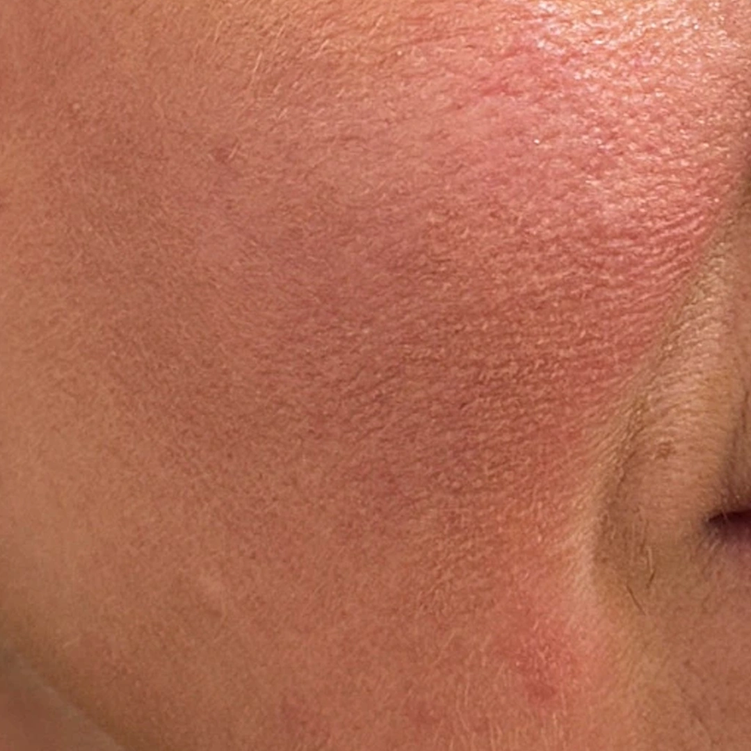 ReVive_Services_Before_&_After_Vitamin_IV_Hydration_Therapy_2 ReVive_Services_Before_&_After_Vitamin_IV_Hydration_Therapy_2