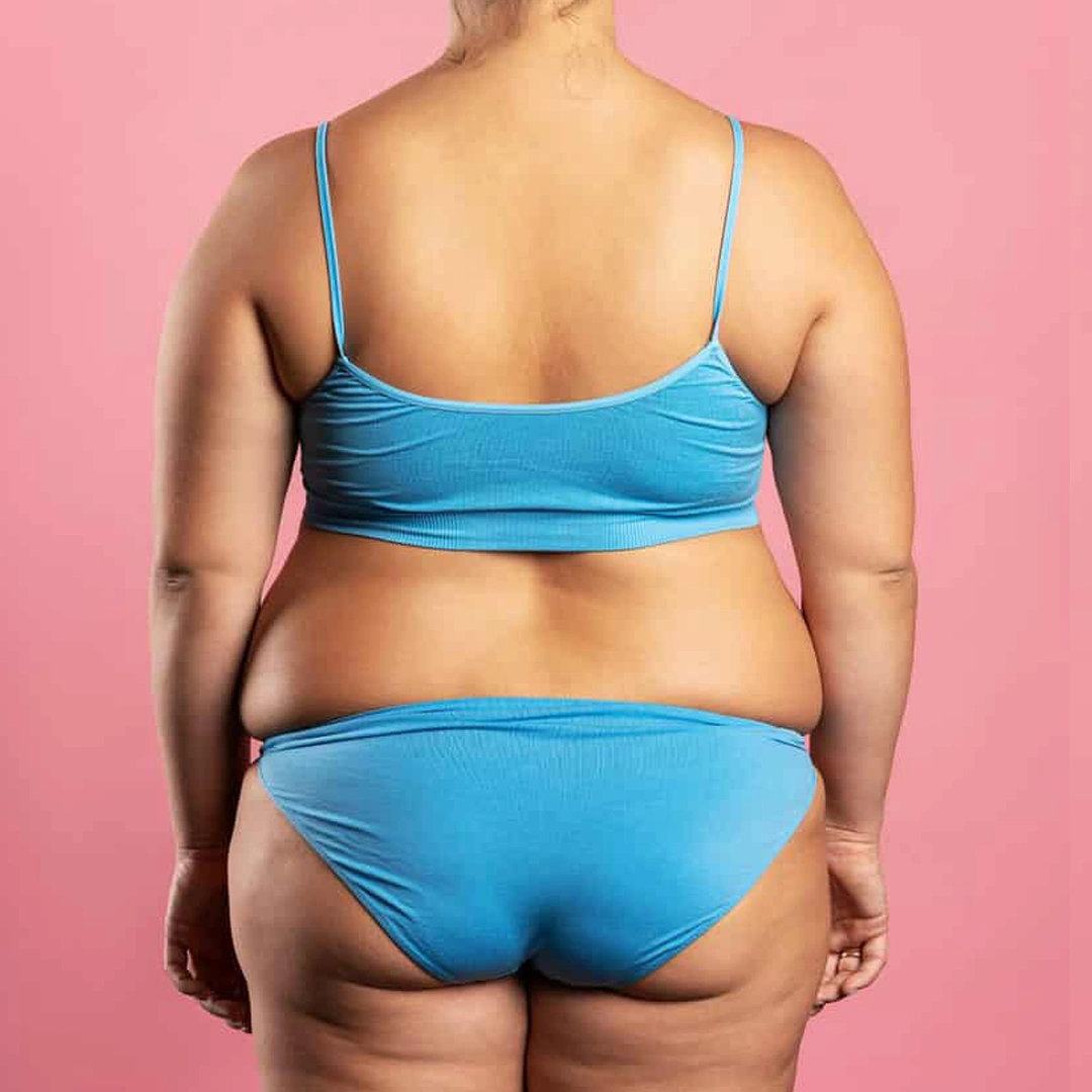 ReVive_Services_Before_&_After_Weight_Management_&_Metabolic_Balance_1 ReVive_Services_Before_&_After_Weight_Management_&_Metabolic_Balance_1