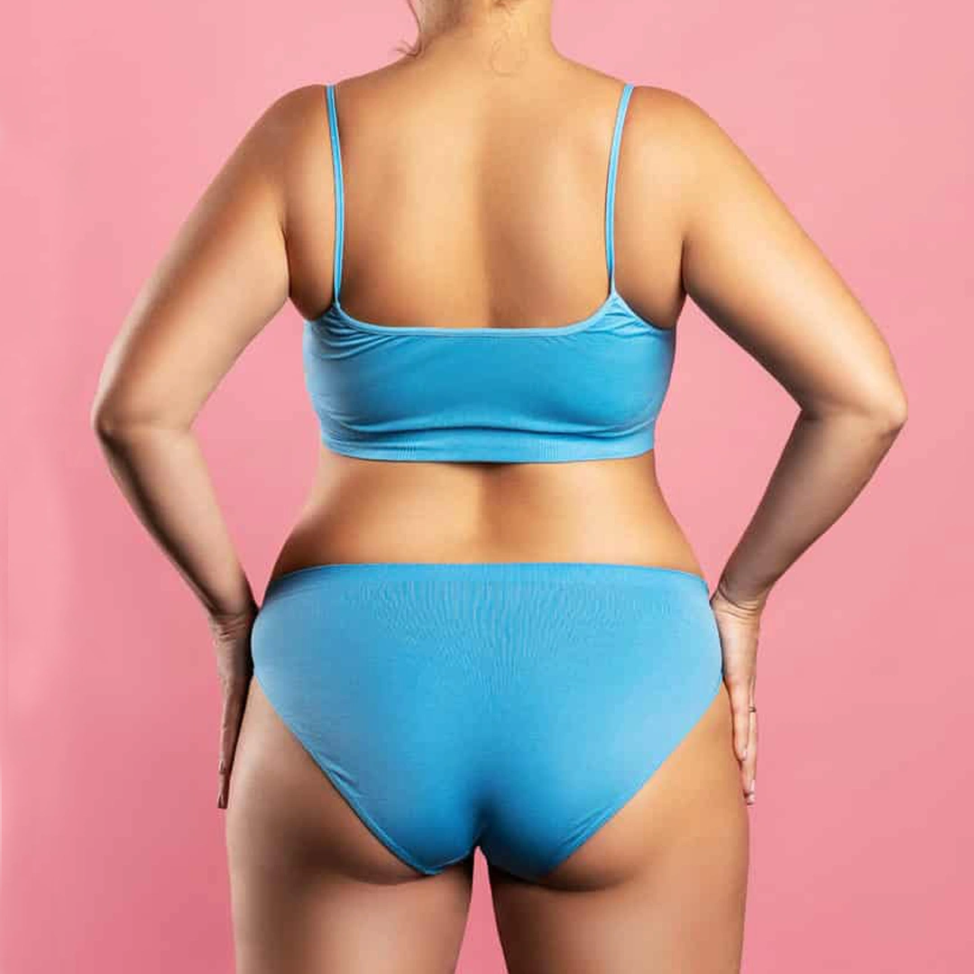 ReVive_Services_Before_&_After_Weight_Management_&_Metabolic_Balance_2 ReVive_Services_Before_&_After_Weight_Management_&_Metabolic_Balance_2