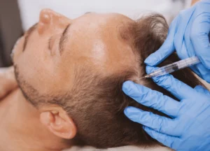 Man undergoing scalp therapy session for healthier hair and men’s wellness treatment in Brevard County